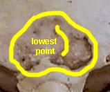 scar~00s.jpg (4992 bytes)