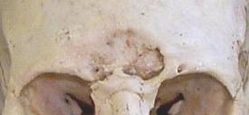 scar~01s.jpg (5909 bytes)